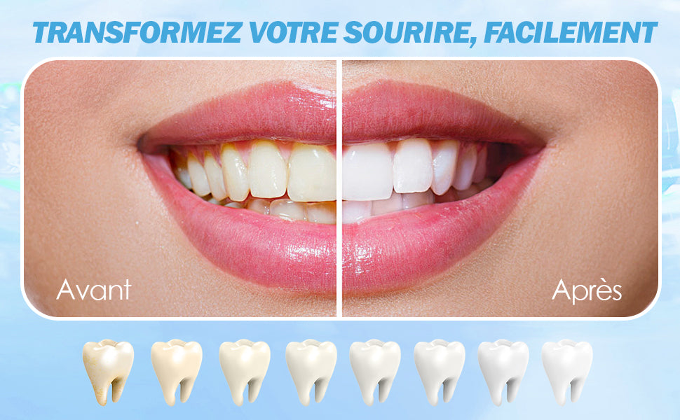 Purple Smile – Bandes Blanchissantes